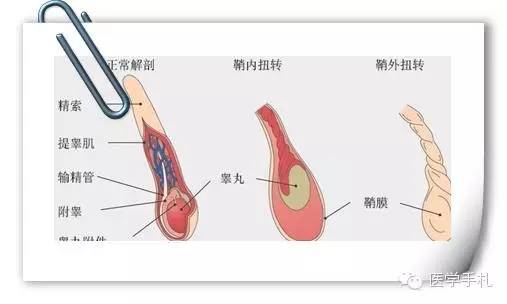 睾丸体检的重要性及其相关知识普及与理解