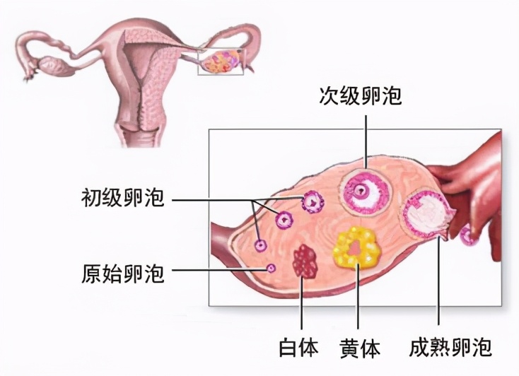 夫妻玩闹引发意外，妻子黄体破裂敲响健康警钟