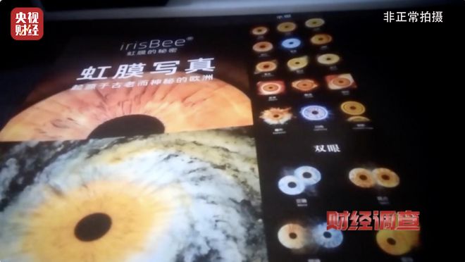 人类虹膜生物信息，独一无二的终身标识